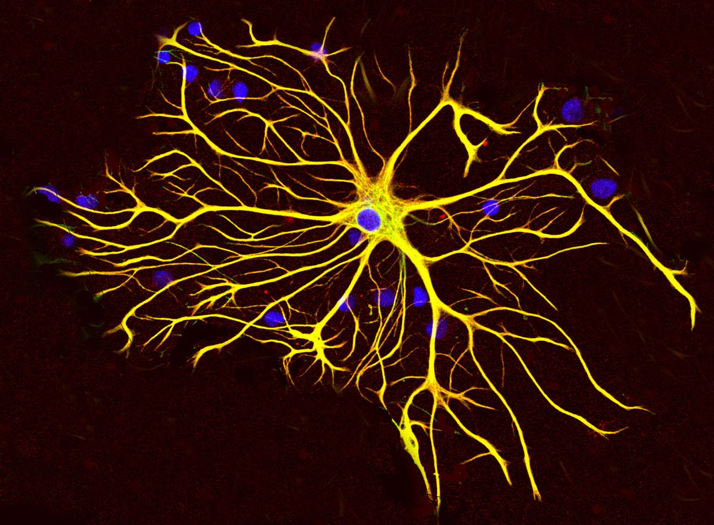 "This is an extraordinary mechanism in the healthy, mature brain that creates diversity of brain cells," says Keith Murai. "Now, our goal is to see how this mechanism is affected in different brain diseases."