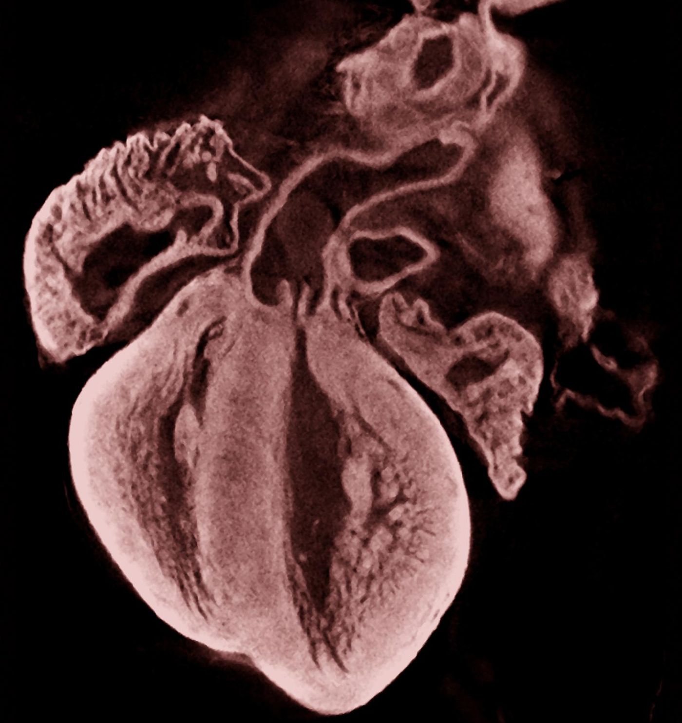 A frontal section of a mouse heart at embryonic day 17.5 showing normal anatomy, which can be disrupted by short-term exposure to hypoxia during gestation.