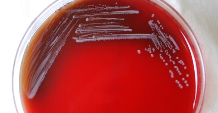 Gram-negative Brucella abortus bacteria, grown on a medium of sheep's blood agar / Credit: CDC/ Dr. Todd Parker, Audra Marsh