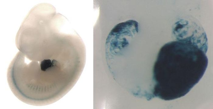 Left: mouse embryo is showing enhancer activity (blue staining) in the developing heart. Right: closeup of this heart showing that the enhancer is active in the left ventricle, left atrium, and right atrium.
