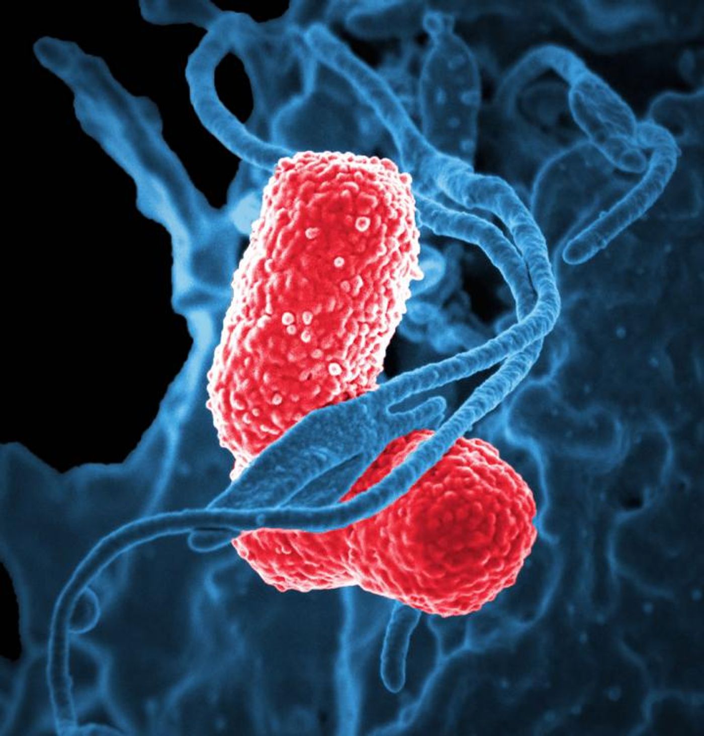 Klebsiella pneumoniae bacterium | Source: CDC Public Health Image Library