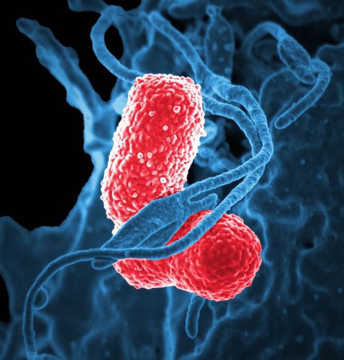 Klebsiella pneumoniae bacterium | Source: CDC Public Health Image Library