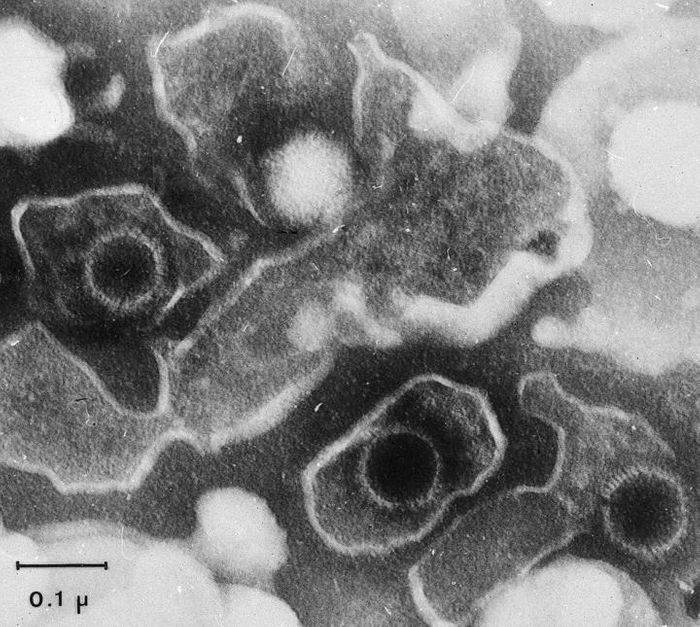 The Epstein-Barr virus prevents infected cells from being attacked by the immune system.