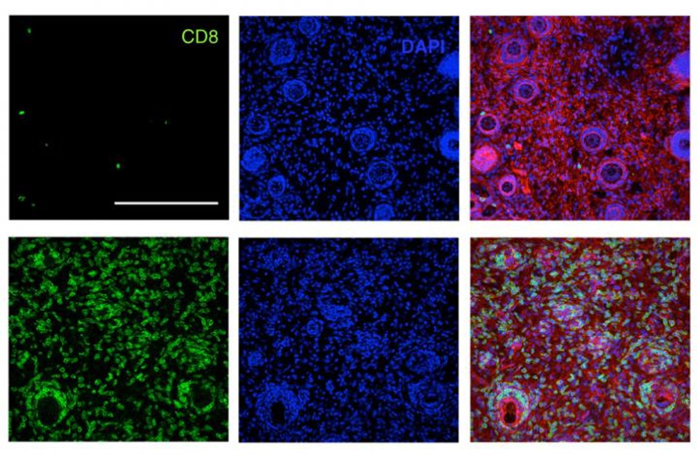 T cells are key to the adaptive immune response. In this image, the top row shows few T cells in untreated mice, while the bottom rows show many T cells produced after immunotherapy treatment. Credit: MIT