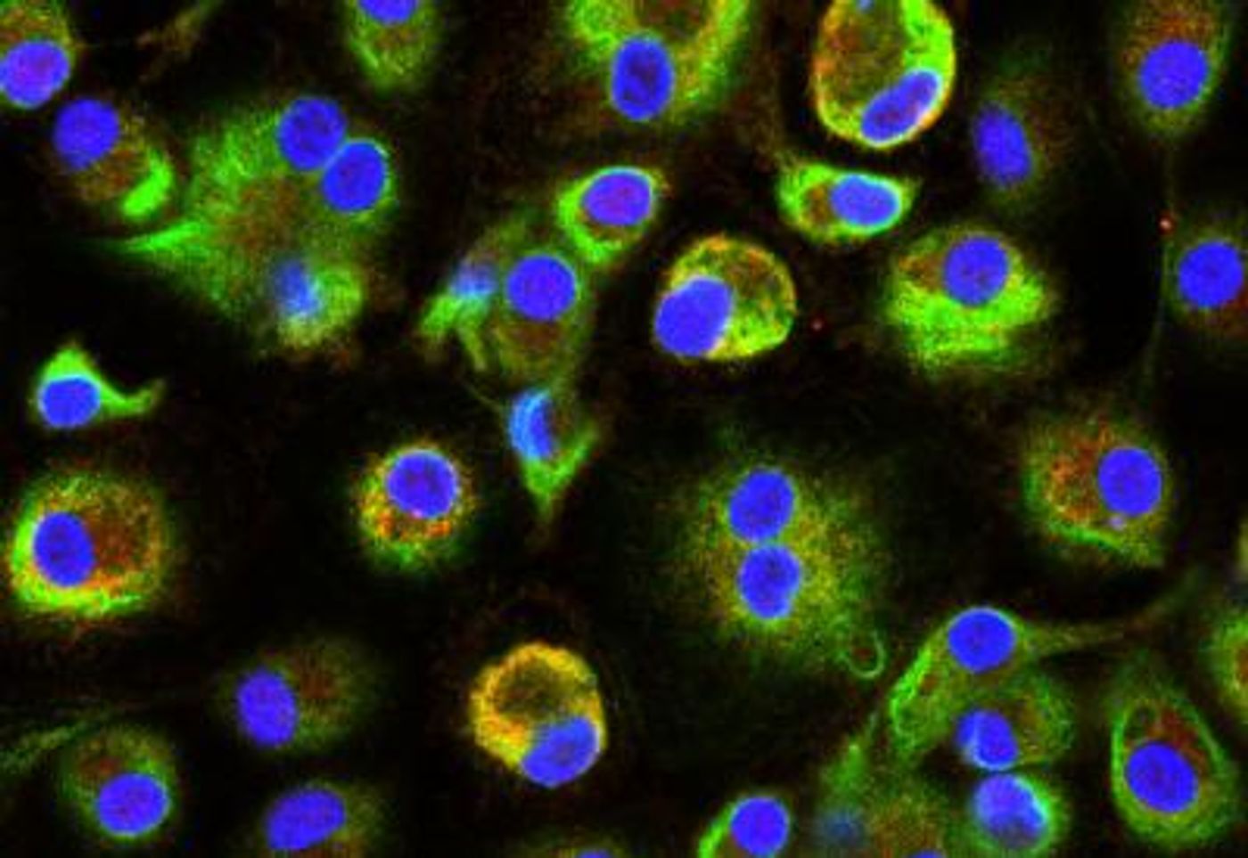 Immunofluorescence staining for PARP9 (red) and PARP14 (green) with nuclei shown in blue.