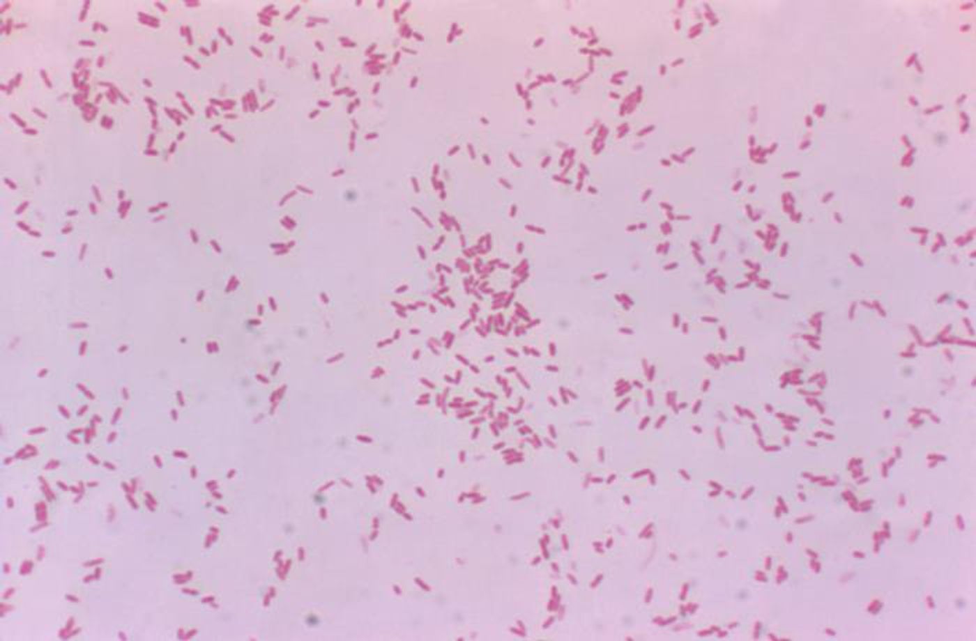 A photomicrograph depicting numerous, Gram-negative, Aeromonas hydrophila bacteria. / Credit: CDC/ Dr. W.A. Clark
