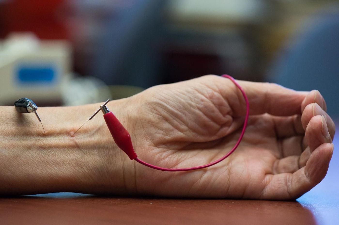 The study shows repetitive electroacupuncture evokes a long-lasting action in lowering blood pressure. Credit: Chris Nugent / UCI