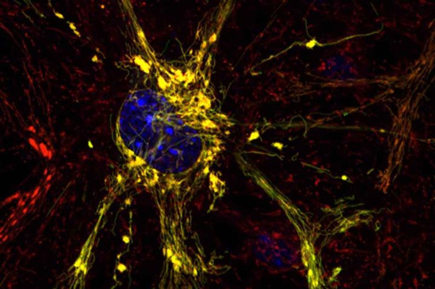 Shown is a diseased neuron, with disease indicated by clumpy yellow mitochondria. Scientists at Washington University School of Medicine in St. Louis and Stanford University have designed small compounds that have the potential to correct mitochondrial dysfunction that leads to Charcot-Marie-Tooth disease and other conditions involving mitochondria, the cells' energy factories./Credit: G. Dorn and A. Franco