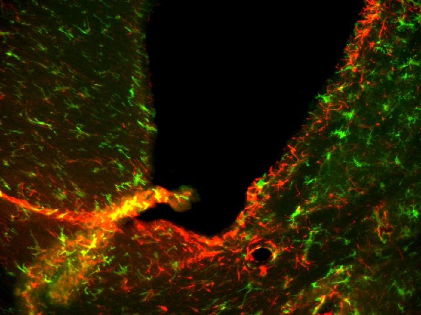 A microscope view of neurons (green) and immune cells (red) inside the brain of a mouse with a drug-resistant form of a disease closely related to MS. Credit: Mari Shinohara