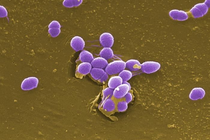 An SEM image depicting Enterococcus faecalis bacteria / Credit: CDC/ Pete Wardell