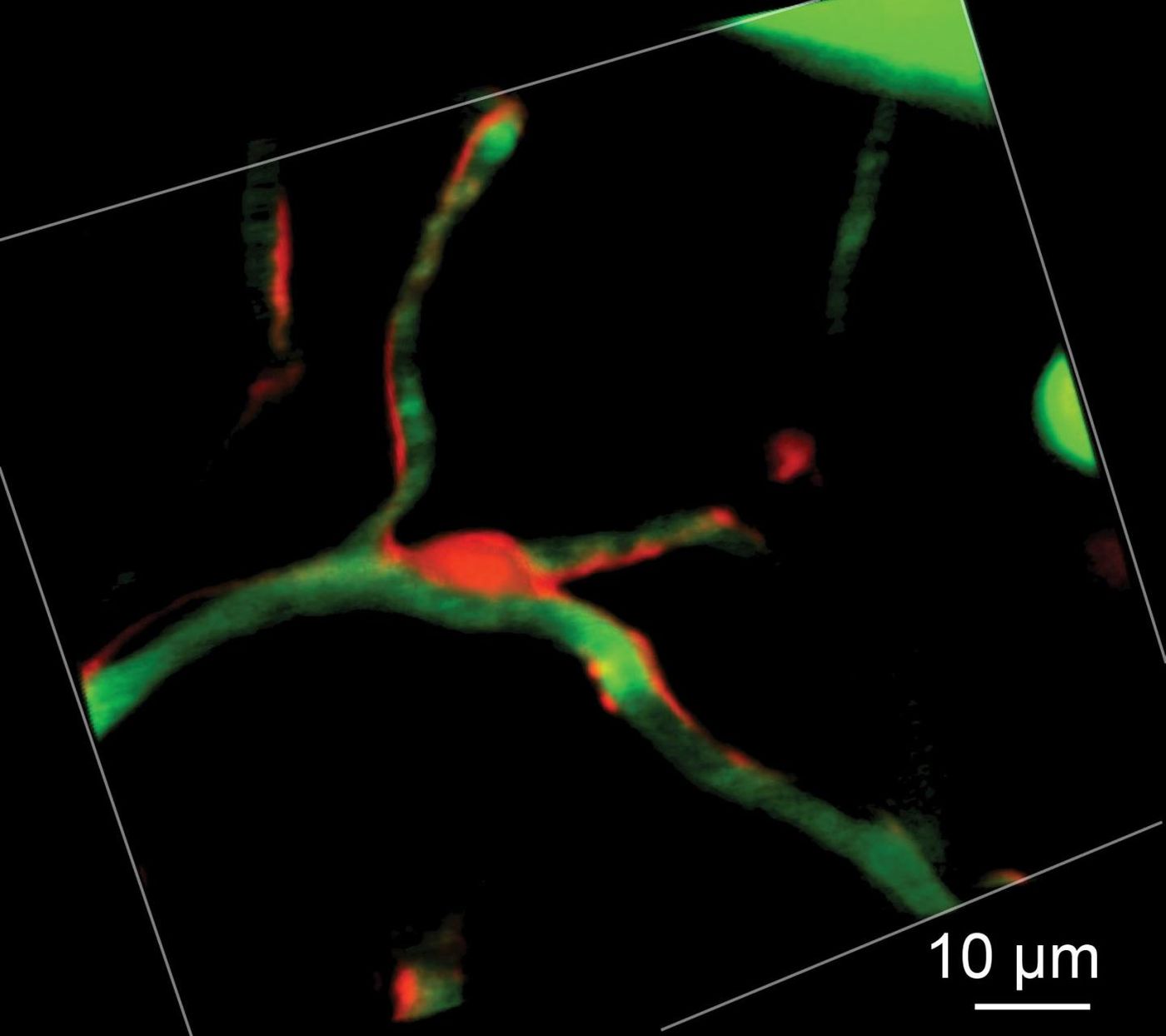 A fluorescent pericyte cell body (red) with processes extending along adjacent capillaries (green). Credit: Andy Y. Shih, Ph.D., and Robert Underly