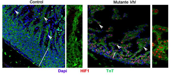 Midgestation mouse heart sections show the loss of HIF1 immunofluorescence in the control contrasting with the high levels in the mutant. Source: CNIC