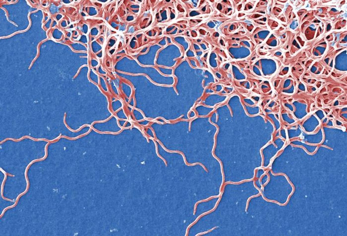 A digitally colorized SEM image of Borrelia burgdorferi bacteria, derived from a pure culture. This pathogen causes Lyme disease, a zoonotic ailment transmitted from ticks to humans / Credit: CDC/ Claudia Molins / Photo Credit: Janice Haney Carr