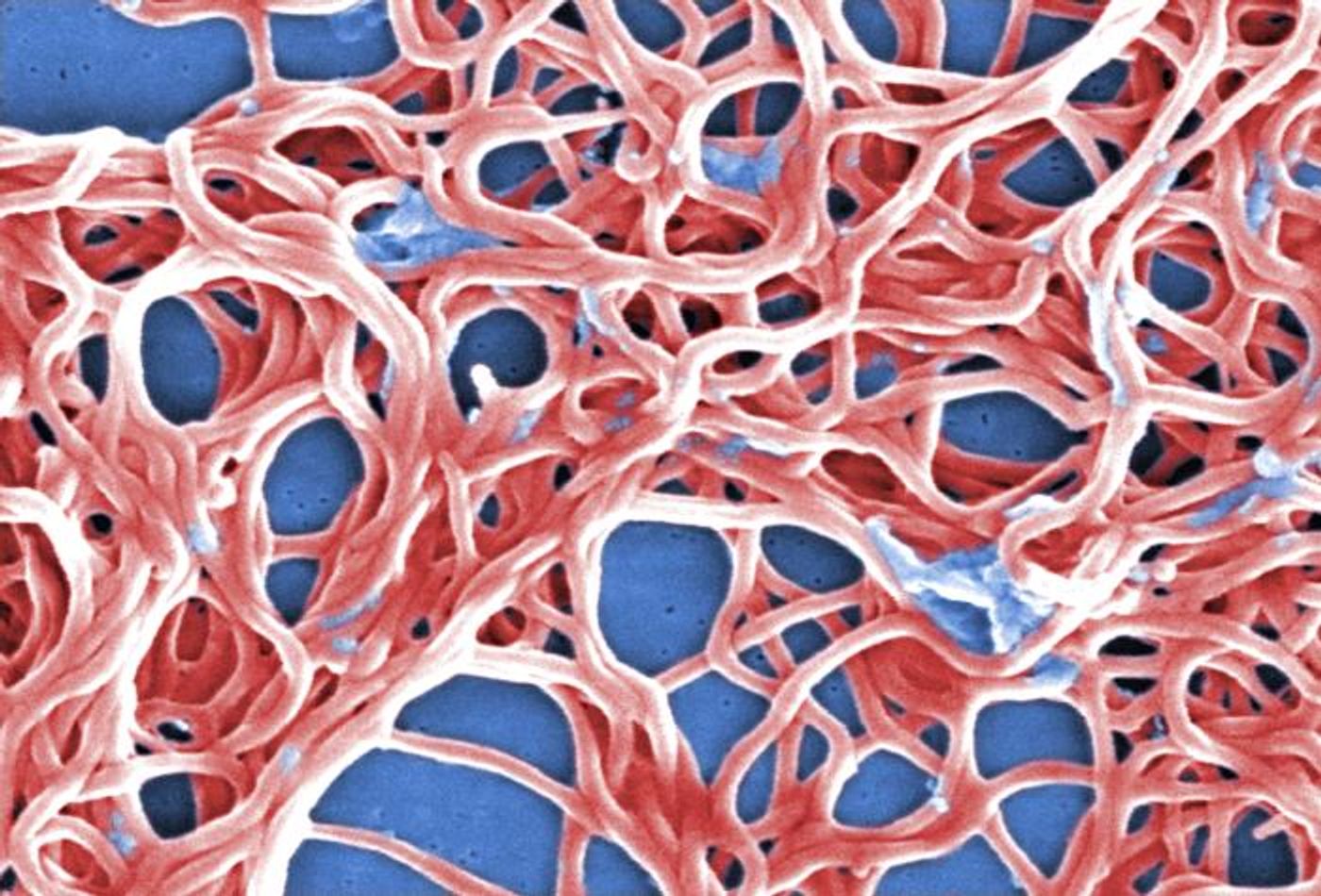 A colorized SEM image depicts of numerous Borrelia burgdorferi bacteria from a pure culture. This pathogenic organism causes Lyme disease, transmitted to humans by way of a tick bite. / Credit: CDC/ Claudia Molins