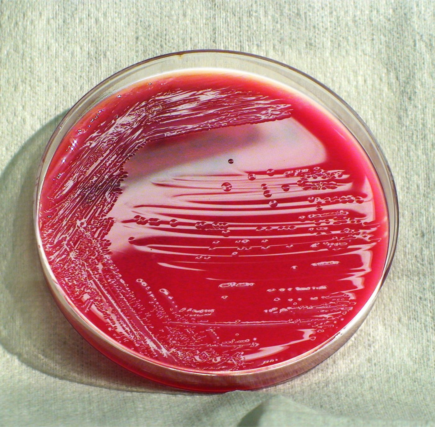 A strain of Enterobacter bacteria grows on a sheep's blood agar plate / Credit: CDC/Amanda Moore, MT; Todd Parker, PhD; Audra Marsh