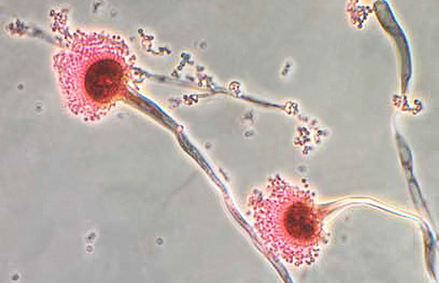 This photomicrograph reveals some of the ultrastructural morphology displayed by the fungal organism Aspergillus fumigatus. / Credit: CDC/Public Health Image Library