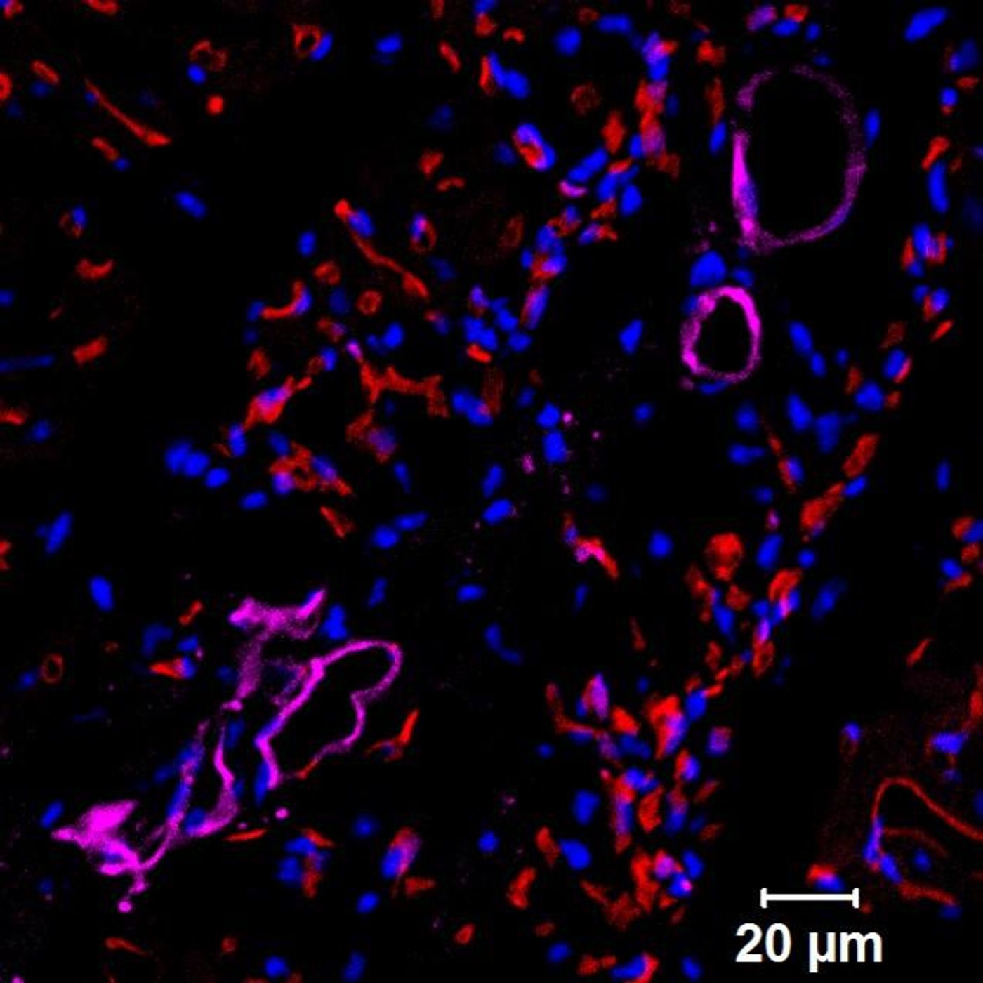 A mouse heart section showing human progenitor cells that formed functional human blood vessels. Credit: Jalees Rehman