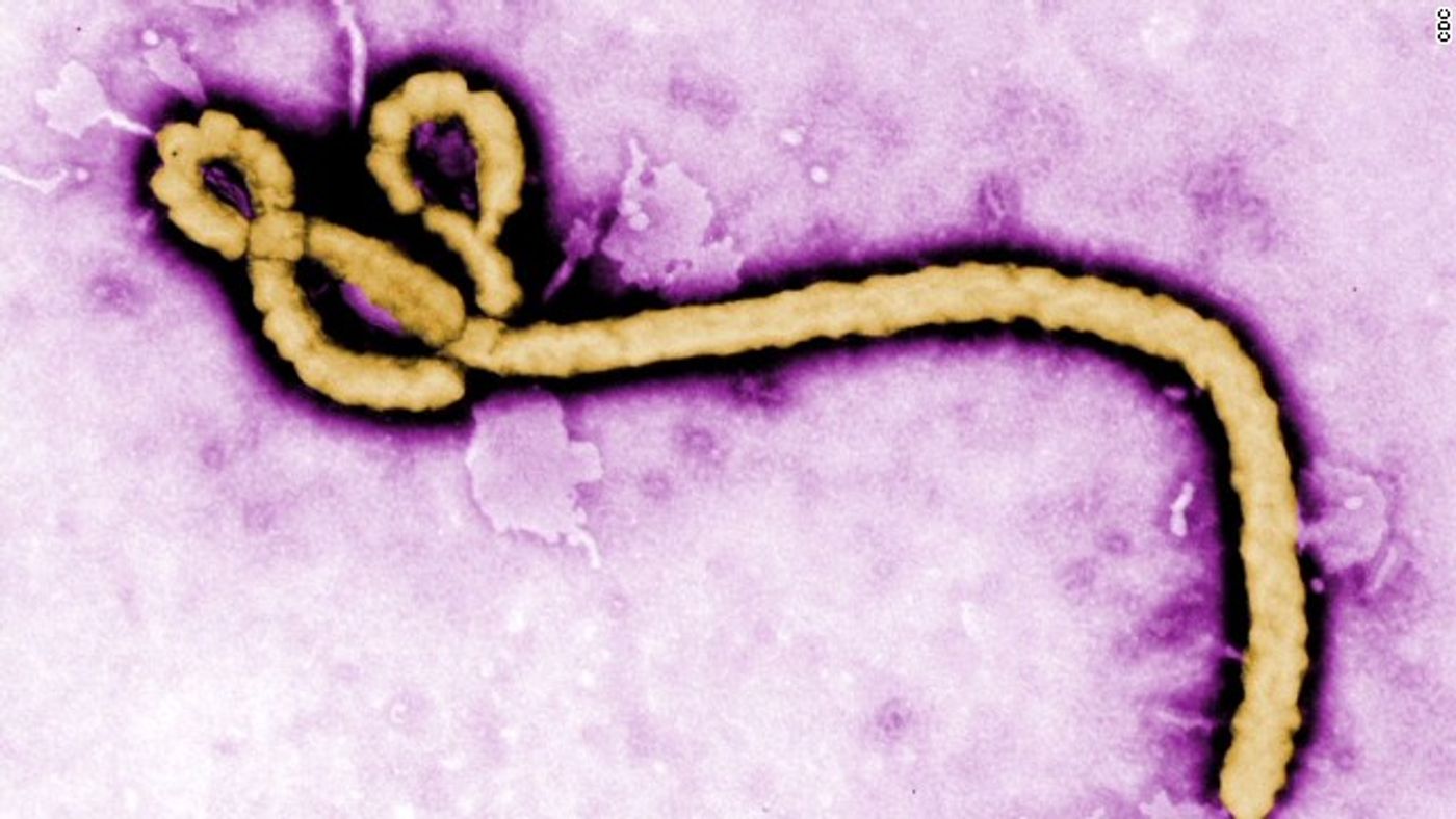 An Ebola virus particle