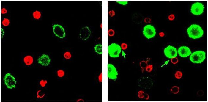 These are T cells (red) and tumor cells (green) incubated with control particles (left) or immunoswitch particles (right). Credit: Alyssa Kosmides