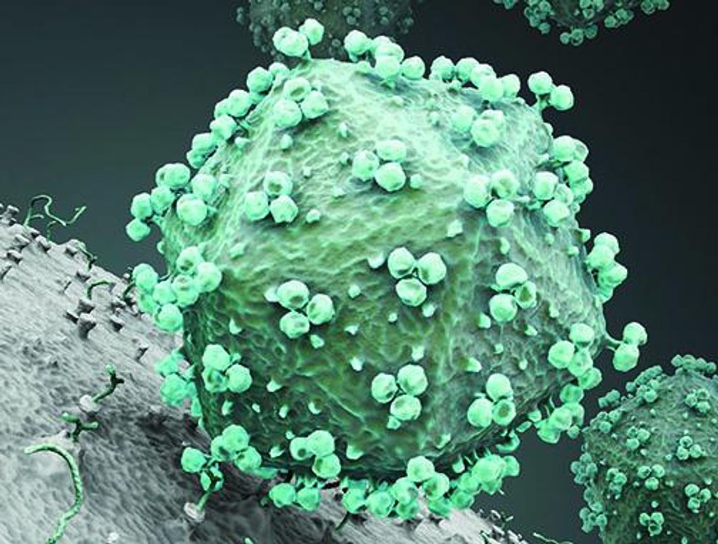 The vaccine candidates used in the study mimic the trimeric envelope protein spikes on the surface of HIV. Rendering of HIV with envelope protein trimers clearly visible on the virus surface. Credit: La Jolla Institute for Allergy and Immunology