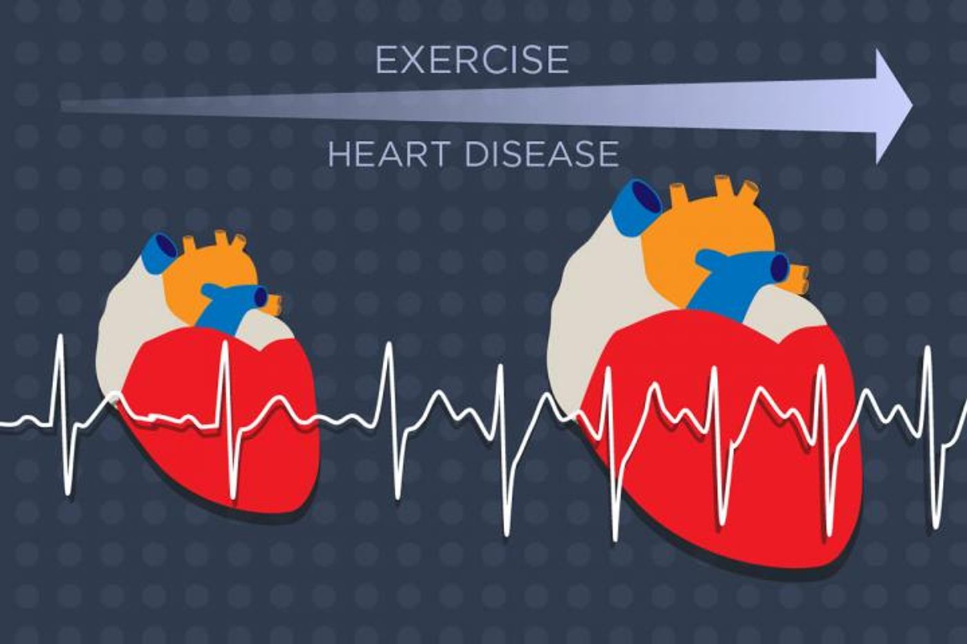 The heart enlarges in response to growing demands from exercise or heart disease. A new study identifies a key molecular player in this process. Credit: Julie McMahon