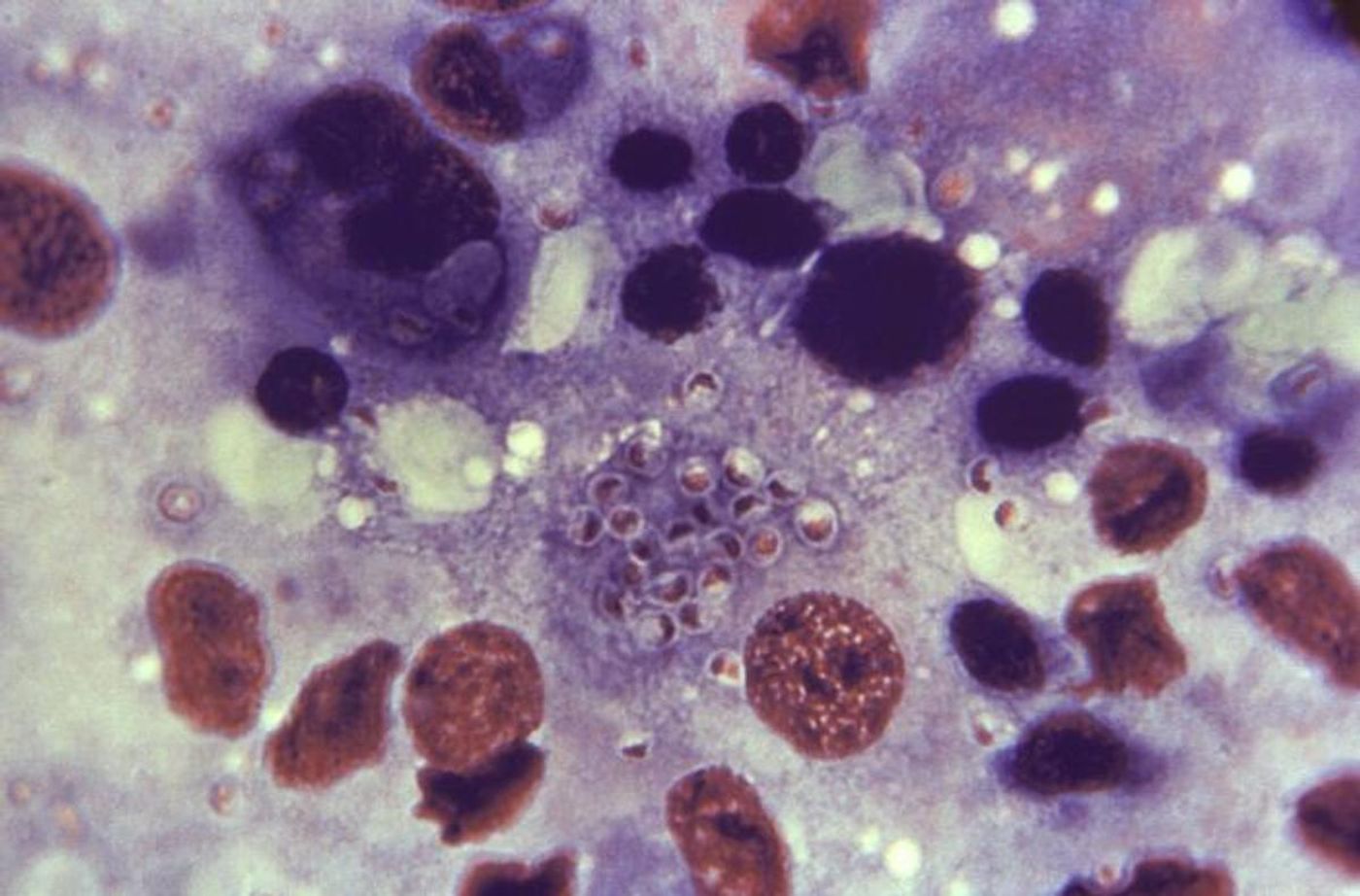 At center,  yeast-staged cells are contained within a macrophage / Credit: CDC 