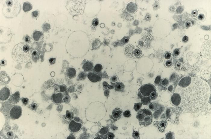 A 49,200X TEM image of cytomegalovirus (CMV) virions  / Credit: CDC