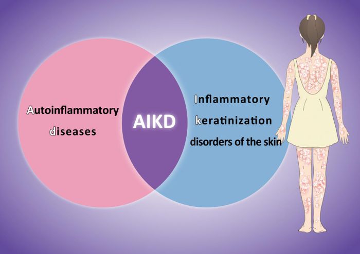 Autoinflammatory keratinization diseases (AIKD), a new class of skin disorders, with a genetic cause rooted in the body's innate immune system. Credit: Nagoya University