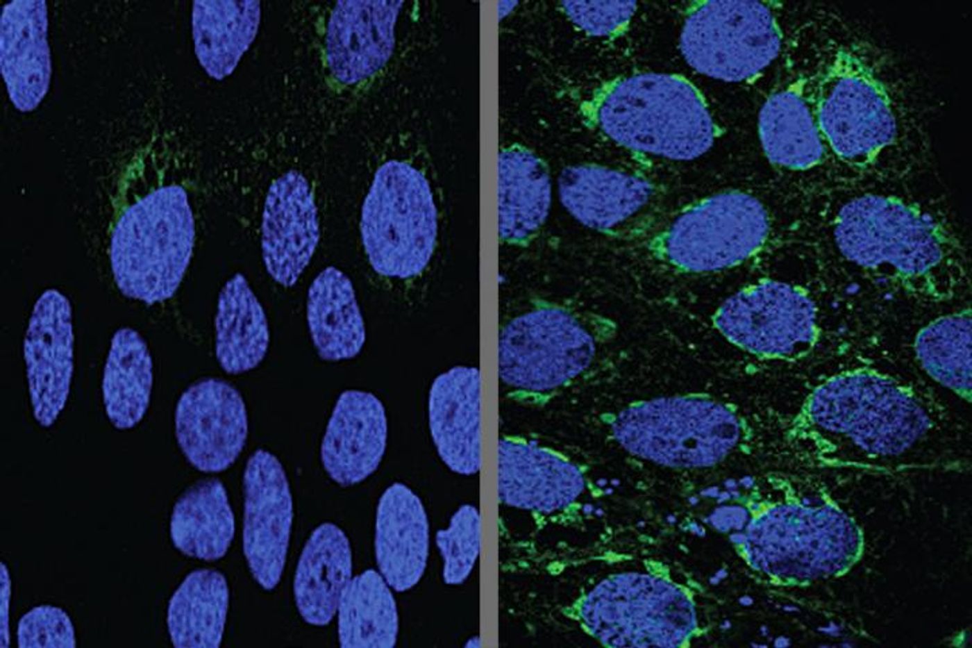 Human placental cells (blue) infected with Zika virus (green) responded to the malaria drug chloroquine (left). Credit: Bin Cao