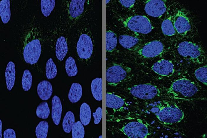 Human placental cells (blue) infected with Zika virus (green) responded to the malaria drug chloroquine (left). Credit: Bin Cao