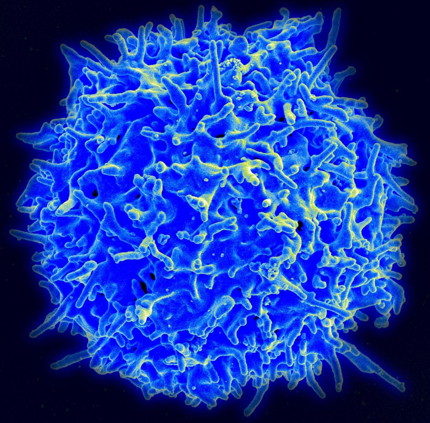 An image of a T cell from a healthy person. Credit: NIH/NIAID