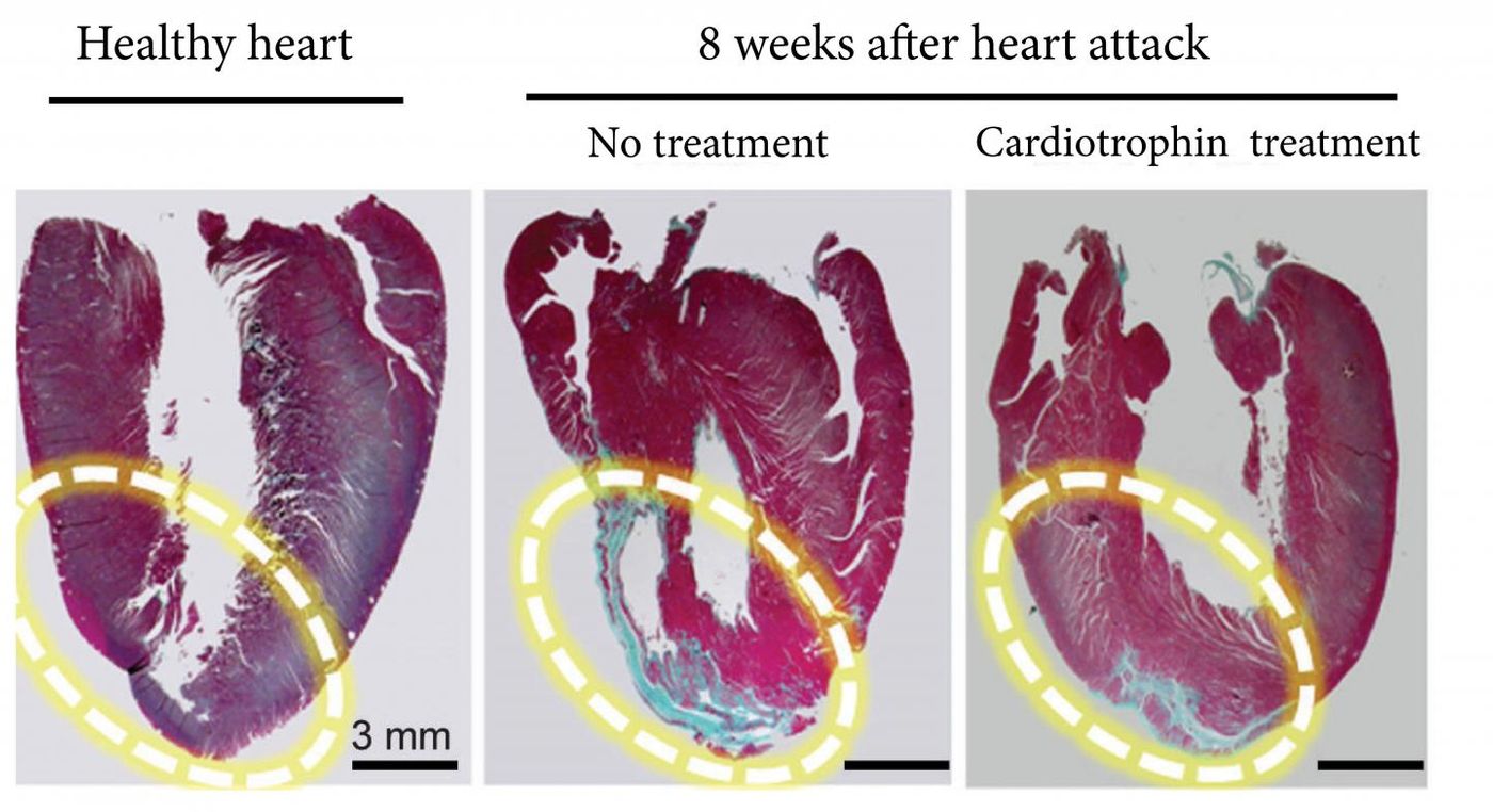 The far right image shows how a cardiotrophin treatment repaired heart muscle after a heart attack in a rat model. The blue areas are scar tissue and the red sections are healthy heart muscle. Source: Cell Research