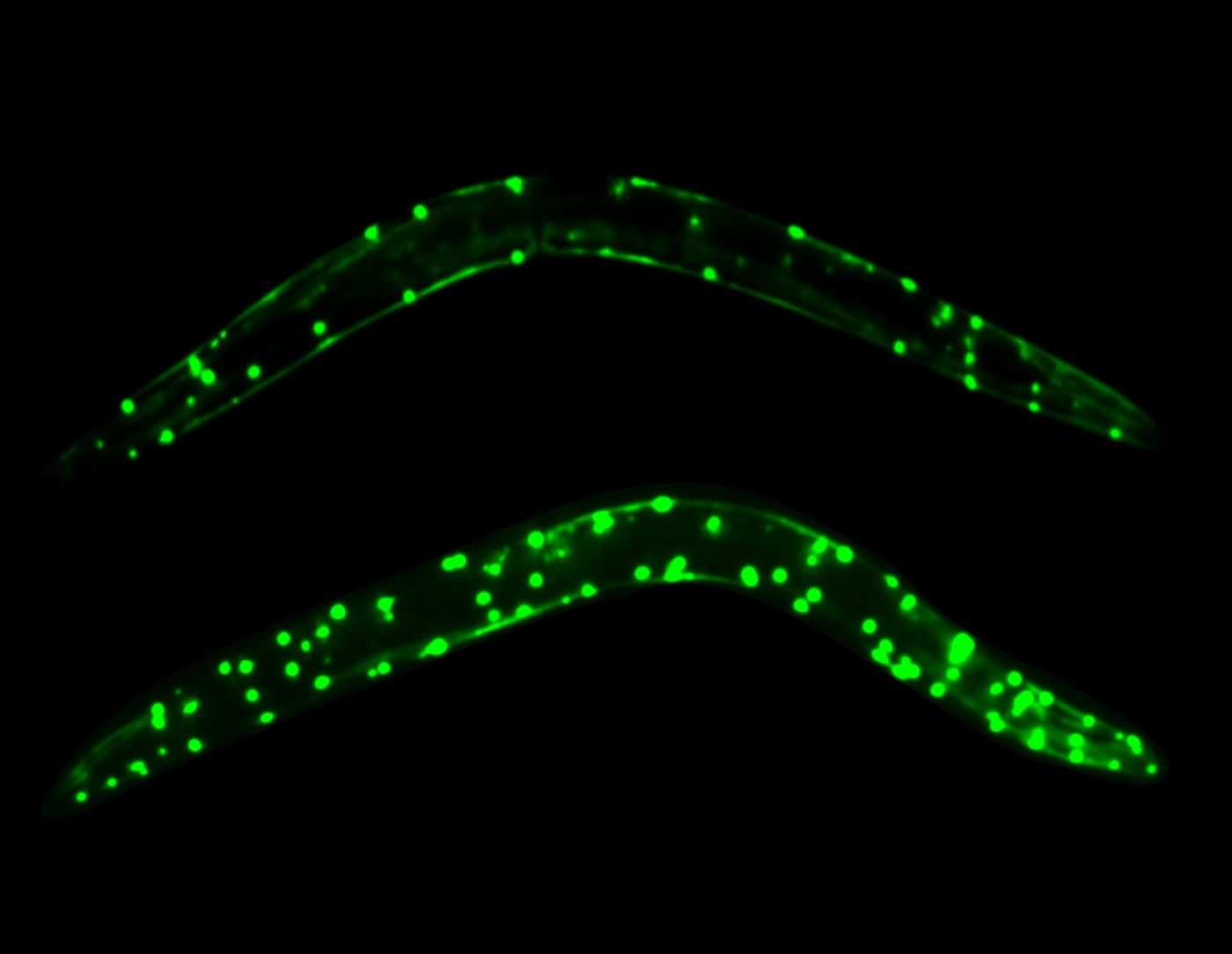 When you decrease autophagy the disease process is exacerbated and when you increase it you get the opposite effect. Aggregation of polyglutamine expansion protein is a hallmark of Huntington's disease and other neurodegenerative diseases. The picture shows that there are more aggregates of green fluorescence protein-labelled polyglutamine expansion protein in autophagy deficient worms (bottom) compared to normal animals (top). Credit: Florida Atlantic University