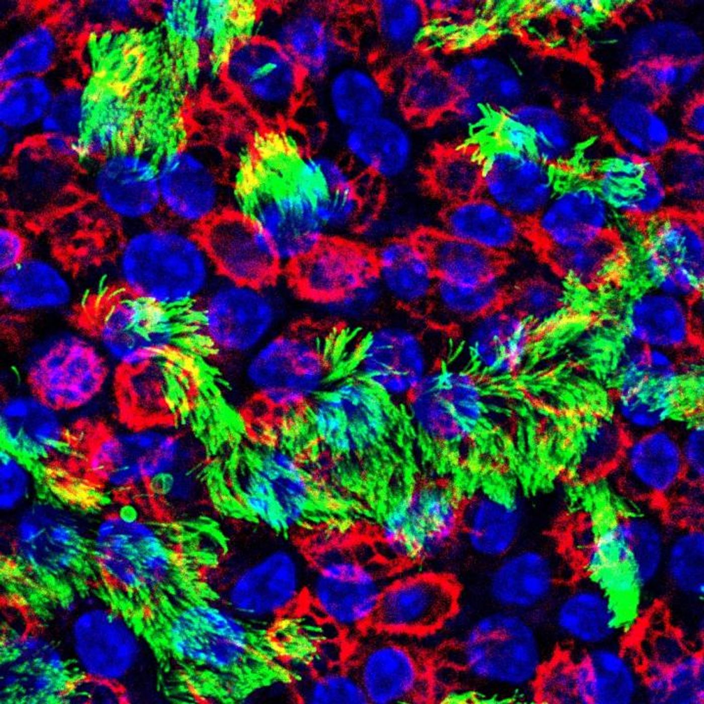 Cells of the upper respiratory tract are where influenza virus infection occurs. Red marks basal cells, green marks ciliated cells, and blue marks cell nuclei. Credit: Rebekah Dumm, Duke University
