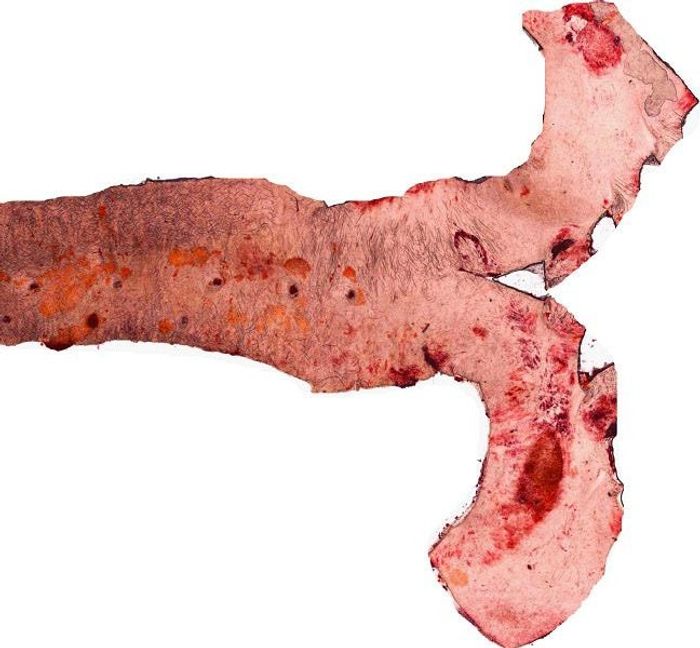 An Aorta after Fixation: Red/orange areas indicate precursors of atherosclerotic plaques called fatty streaks. Credit: Helmholtz Zentrum München/Niopek