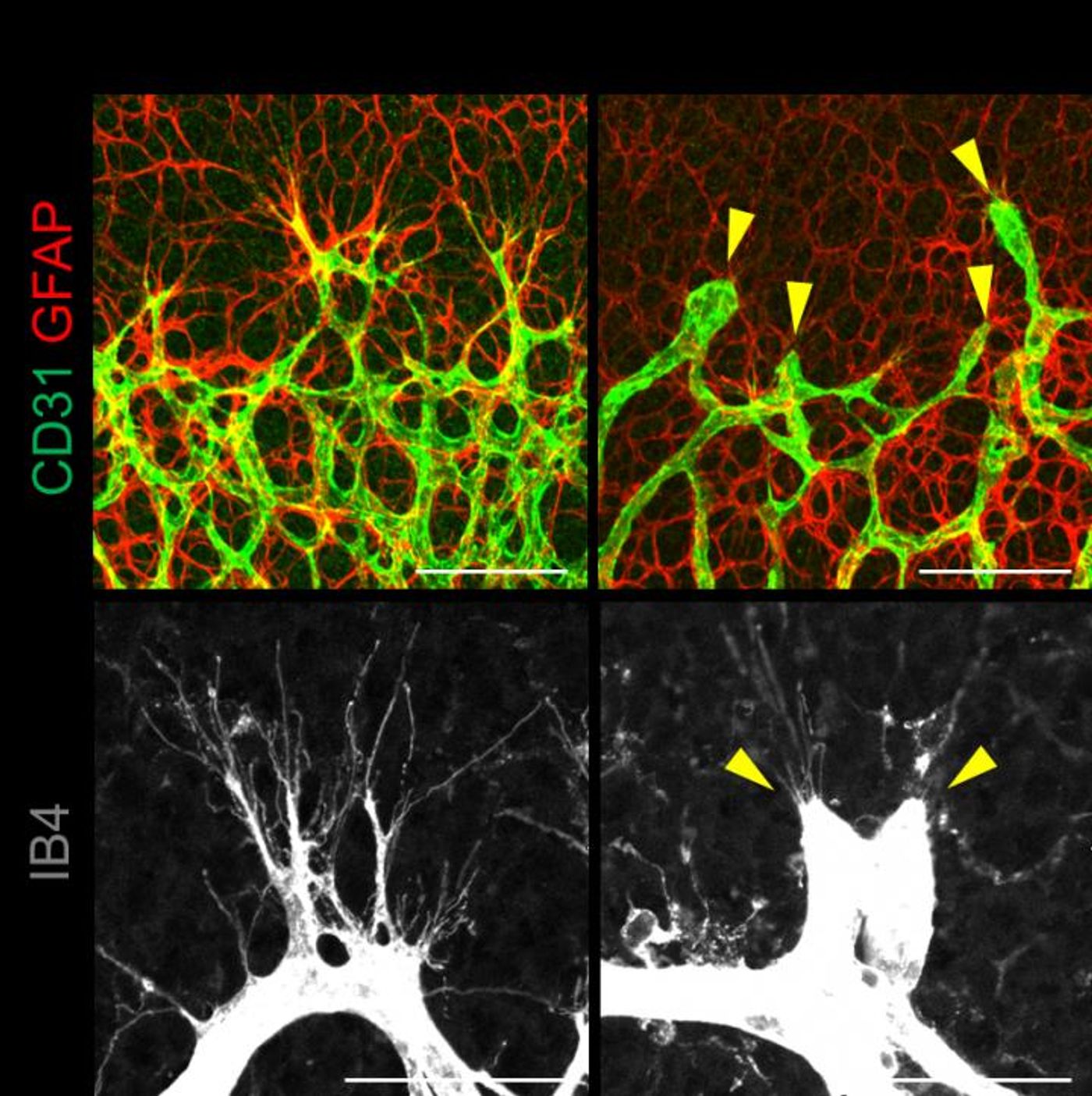 New blood vessels branch out of the main one like thin extensions (right). Normal tissue (right) is compared with tissue lacking YAP/TAZ (left), where the pruned-looking branching are not able to develop. Credit: IBS