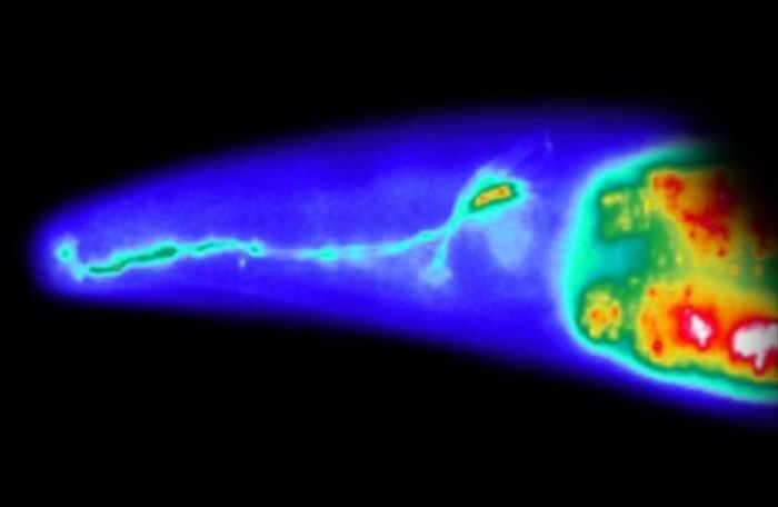 An image of a sensory neuron in a roundworm