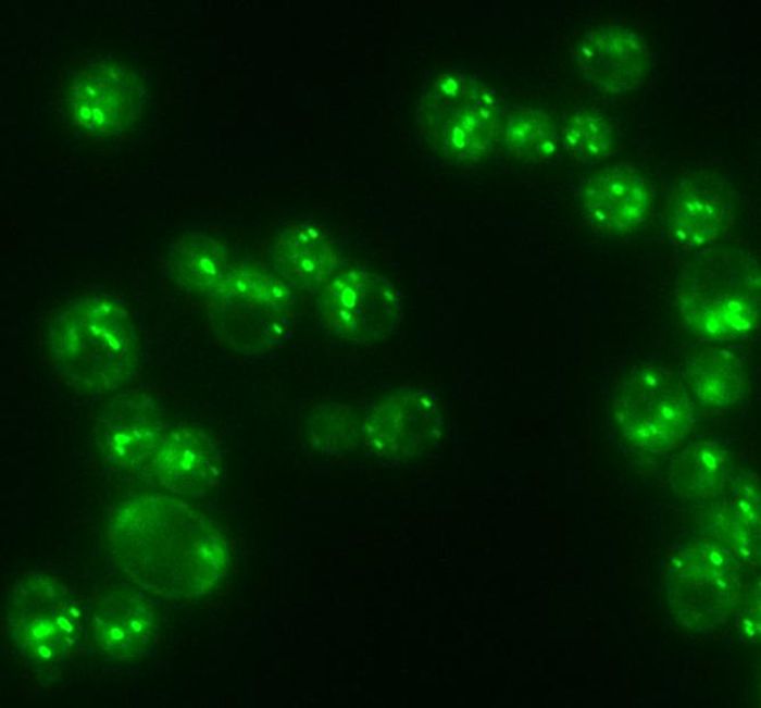 Fat is stored in lipid droplets (bright green spots) in yeast cells, which is analogous to how fat is stored in human tissue. / Credit: Gil-Soo Han/Rutgers University-New Brunswick