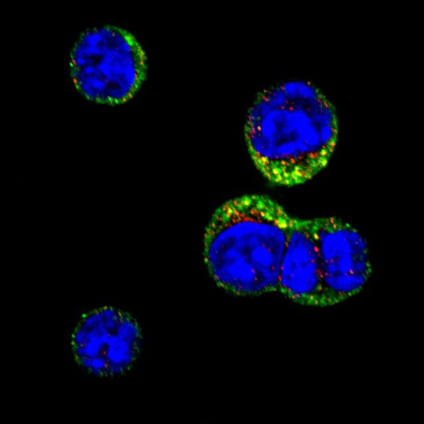 This is a microscopy image showing collections of mRNA molecules, called RNA granules (green), inside B cells that are altering their genes to produce antibodies. DNA is shown in blue. Credit: Dr Manuel Díaz-Muñoz