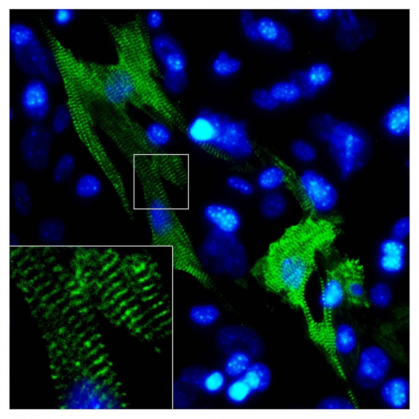 One laboratory method to create healthy heart muscle leads to better organized sarcomeres -- the cells that make heart muscle striated -- stained green here. Credit: Lab of Li Qian, UNC School of Medicine