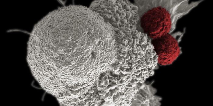 Cytotoxic T cells (red) attacking an oral squamous cancer cell (white) by Rita Elena Serda
