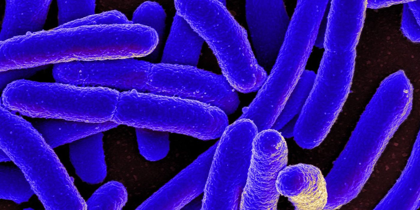 Scanning electron micrograph of Escherichia coli, Credit: NIAID, NIH