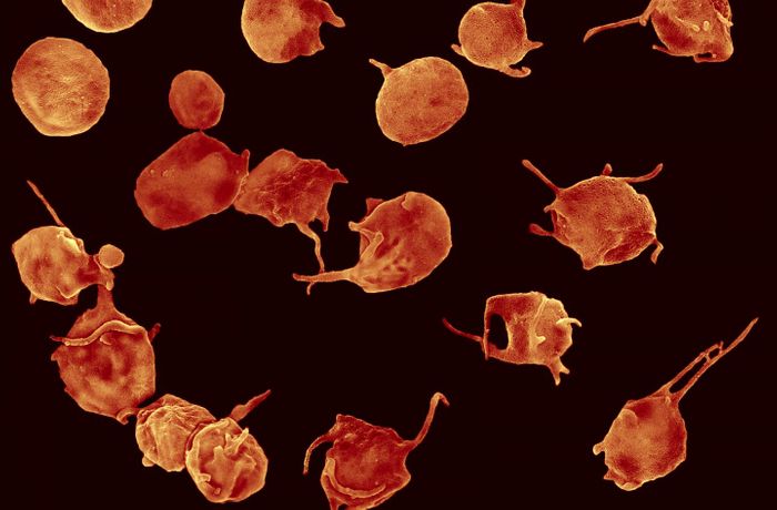 Activated platelets with filopodia. Image credit: John Weisel, PhD, Perelman School of Medicine, University of Pennsylvania