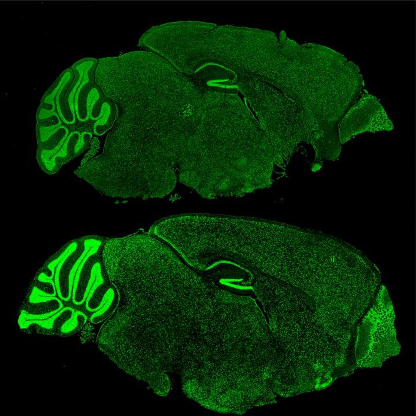 Mouse brains with Fragile X Syndrome (lower) lose the ability to regulate proteins like Brd4 (green). / Credit/copyright: The Rockefeller University