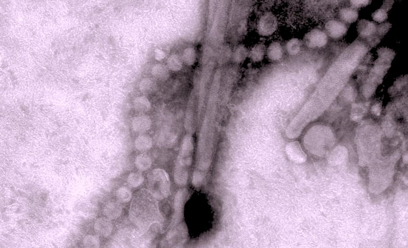 Modified from a negative stained transmission electron microscopic (TEM) image of a influenza A (H7N9) virus. / Credit: CDC/ Cynthia S. Goldsmith and Thomas Rowe