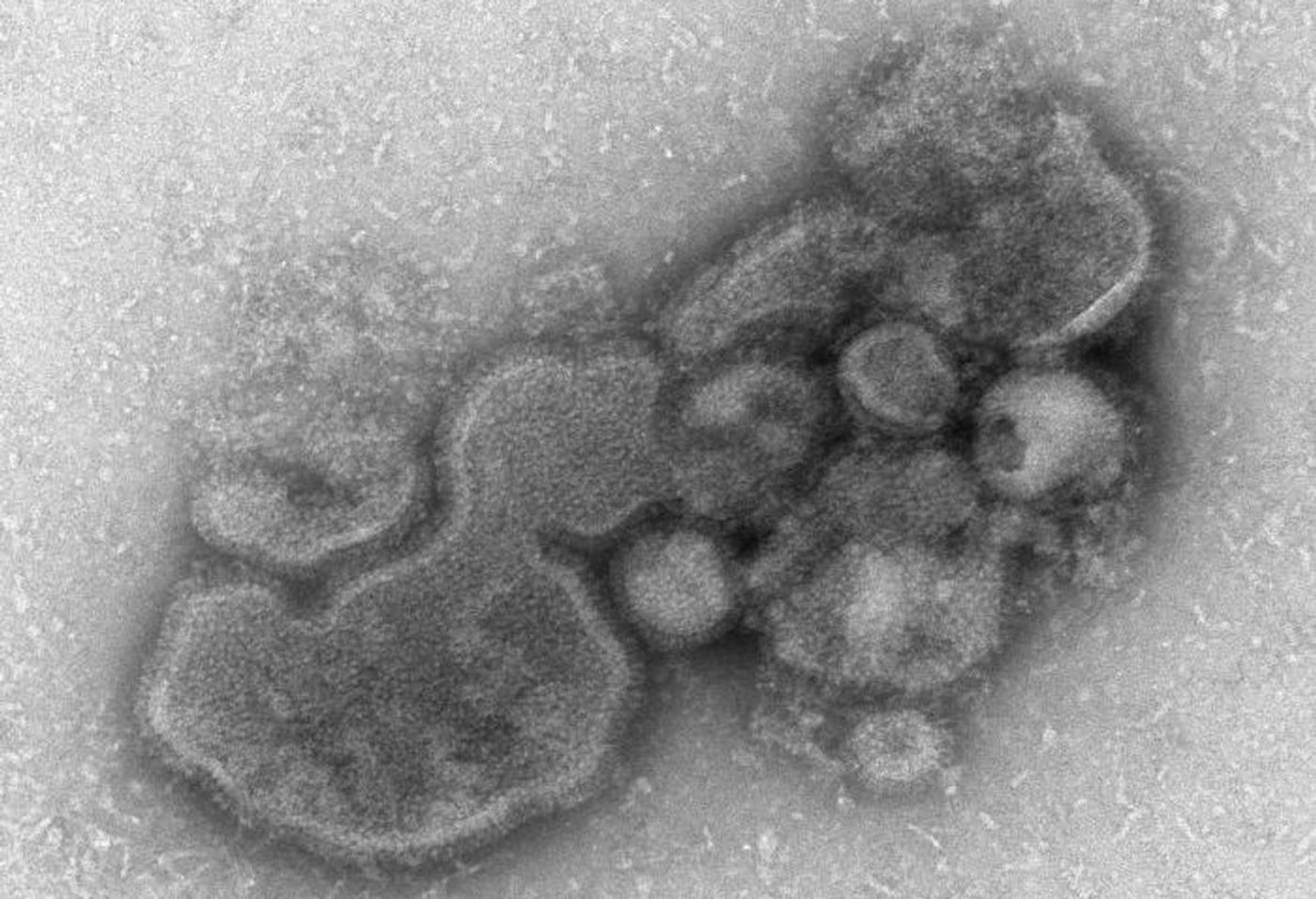 A negative stained TEM image of an influenza A (H7N9) virus.  / Credit: CDC/ Cynthia S. Goldsmith and Thomas Rowe