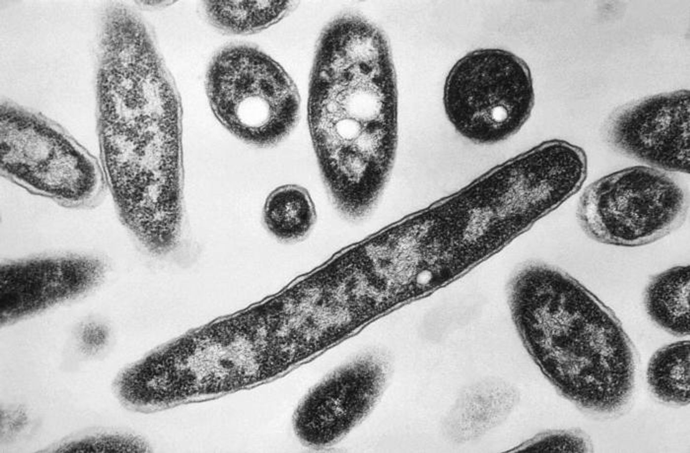 A 90,000X, TEM image of Legionella pneumophila bacteria, grown on a bacteriologic medium.  / Credit: CDC/ Dr. Francis Chandler