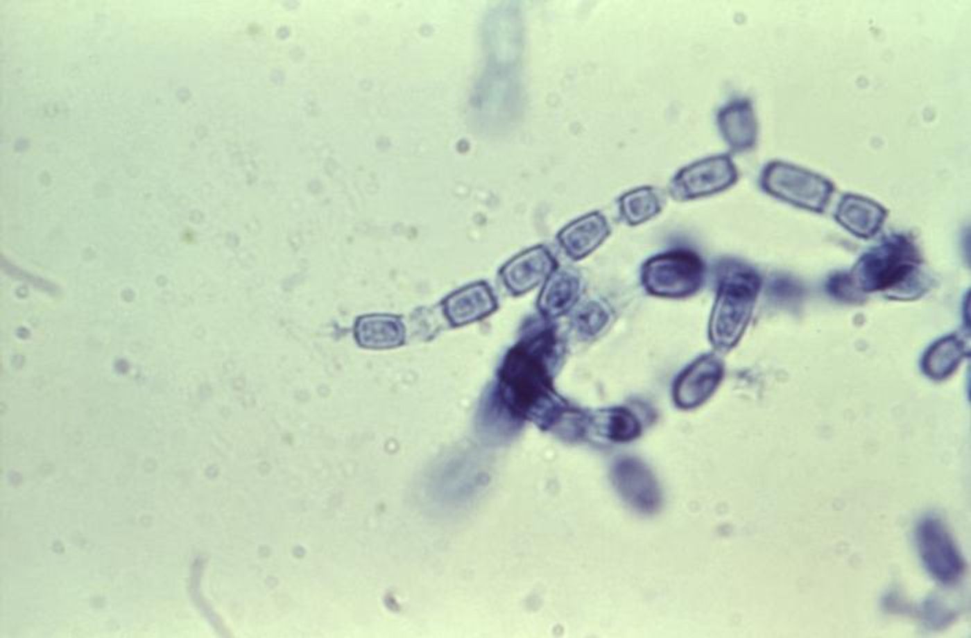 Coccidioides immitis fungal arthrospores / Credit: CDC/ Brinkman