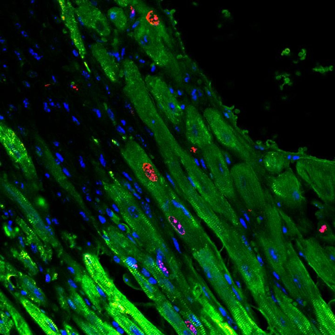 These are cardiomyocytes, green, proliferating in a mouse heart after gel injection. Credit: University of Pennsylvania