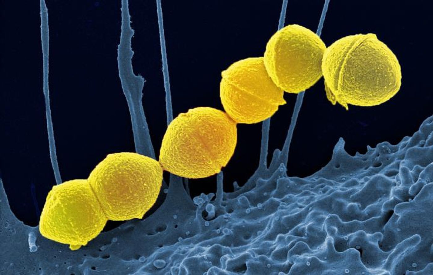 Group A Streptococci are the most common in upper respiratory infections. Georgia Tech researchers suggest finding alternatives to broader spectrum antibiotics in order to preserve antibiotic effectiveness longer for more extreme infections. Credit: National Institute of Allergy and Infectious Diseases of the NIH